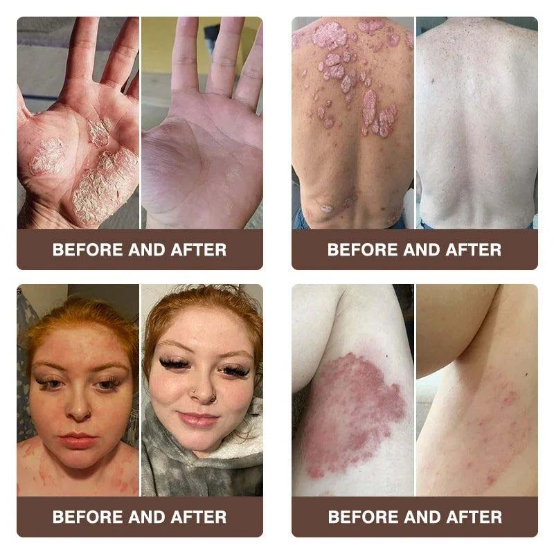 CROAIE ๐๐ฌ๐จ๐ซ๐ข๐๐ฌ๐ข๐ฌ & ๐๐๐ณ๐๐ฆ๐ ๐๐๐ฅ๐ข๐๐ ๐๐ซ๐๐๐ฆ - Image 5