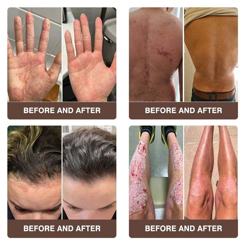 CROAIE ๐๐ฌ๐จ๐ซ๐ข๐๐ฌ๐ข๐ฌ & ๐๐๐ณ๐๐ฆ๐ ๐๐๐ฅ๐ข๐๐ ๐๐ซ๐๐๐ฆ - Image 6