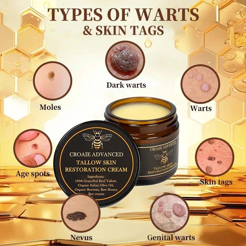 CROAIE ๐๐ฌ๐จ๐ซ๐ข๐๐ฌ๐ข๐ฌ & ๐๐๐ณ๐๐ฆ๐ ๐๐๐ฅ๐ข๐๐ ๐๐ซ๐๐๐ฆ - Image 9