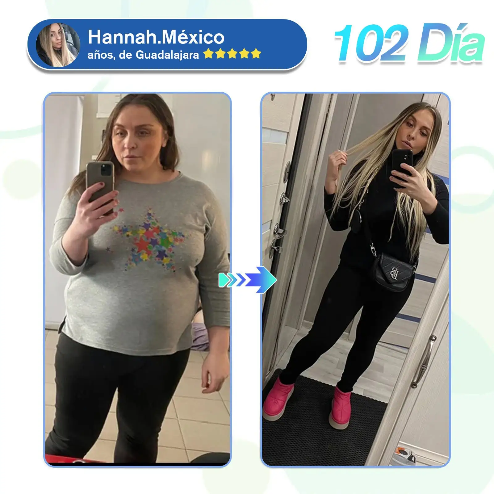 SMGT-Nano-Parche de Microagujas - Image 3