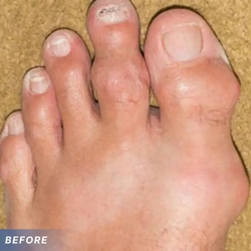 GoutEase Relief Spray - Image 11