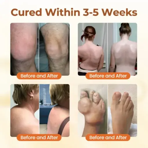 Premium Curcumin Pain Relief Gel - Image 3