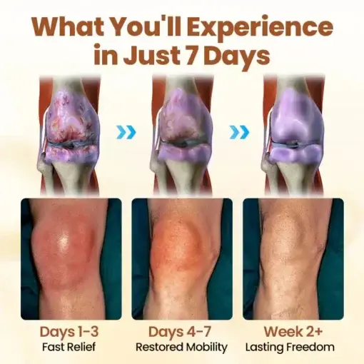 Premium Curcumin Pain Relief Gel - Image 6