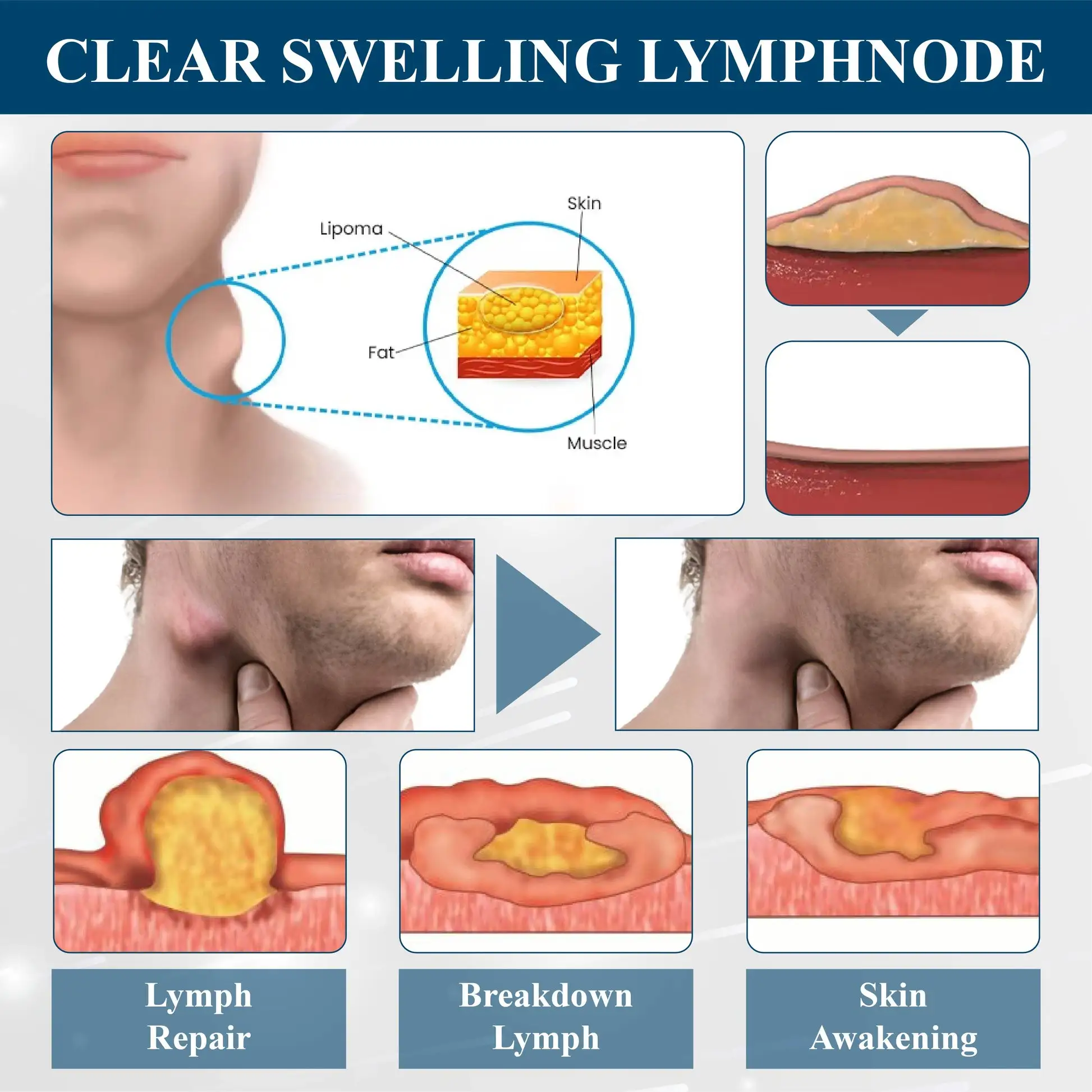Magnetic EdemaCare Insoles - Image 10