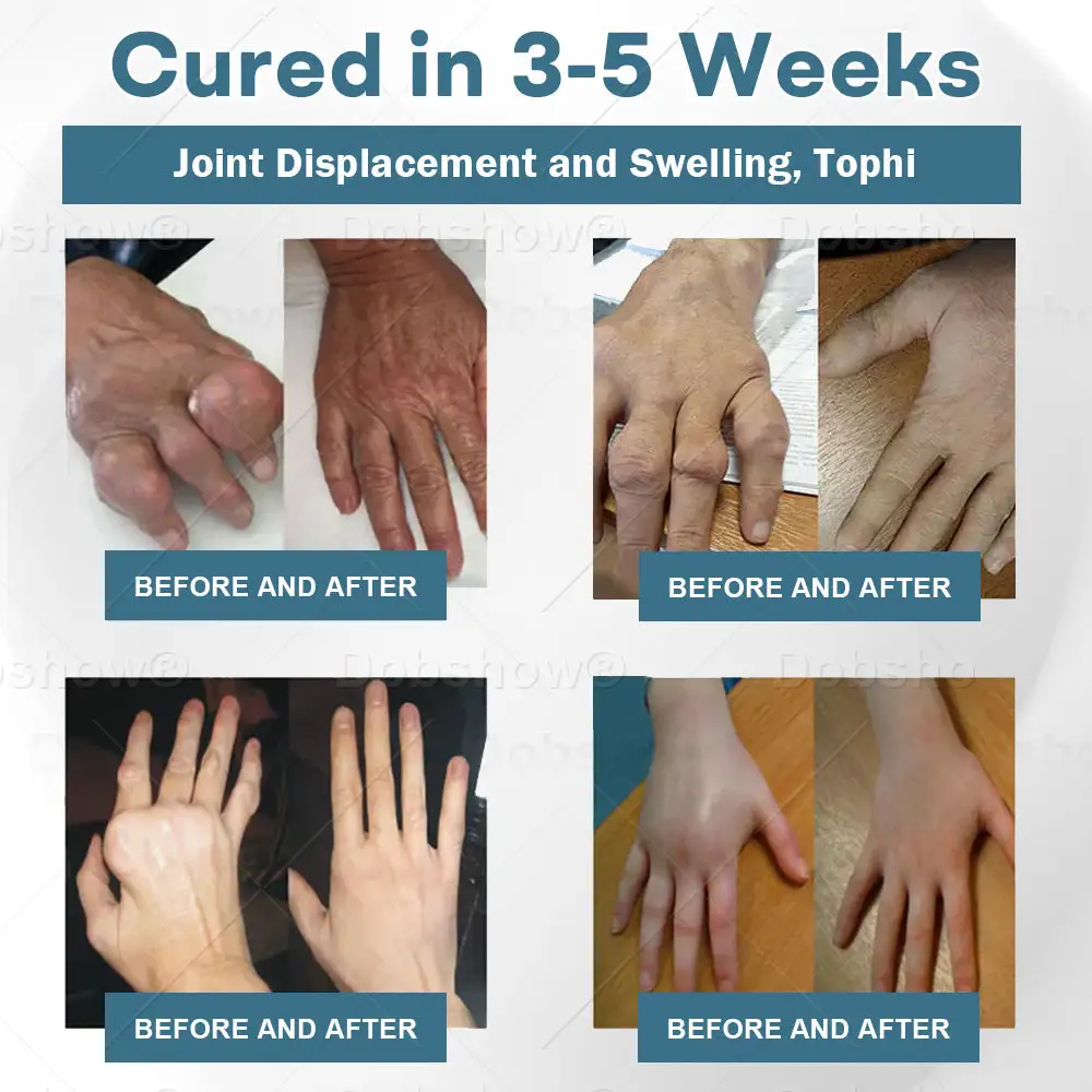 Jointiv BPC-157 Healing Cream - Image 3