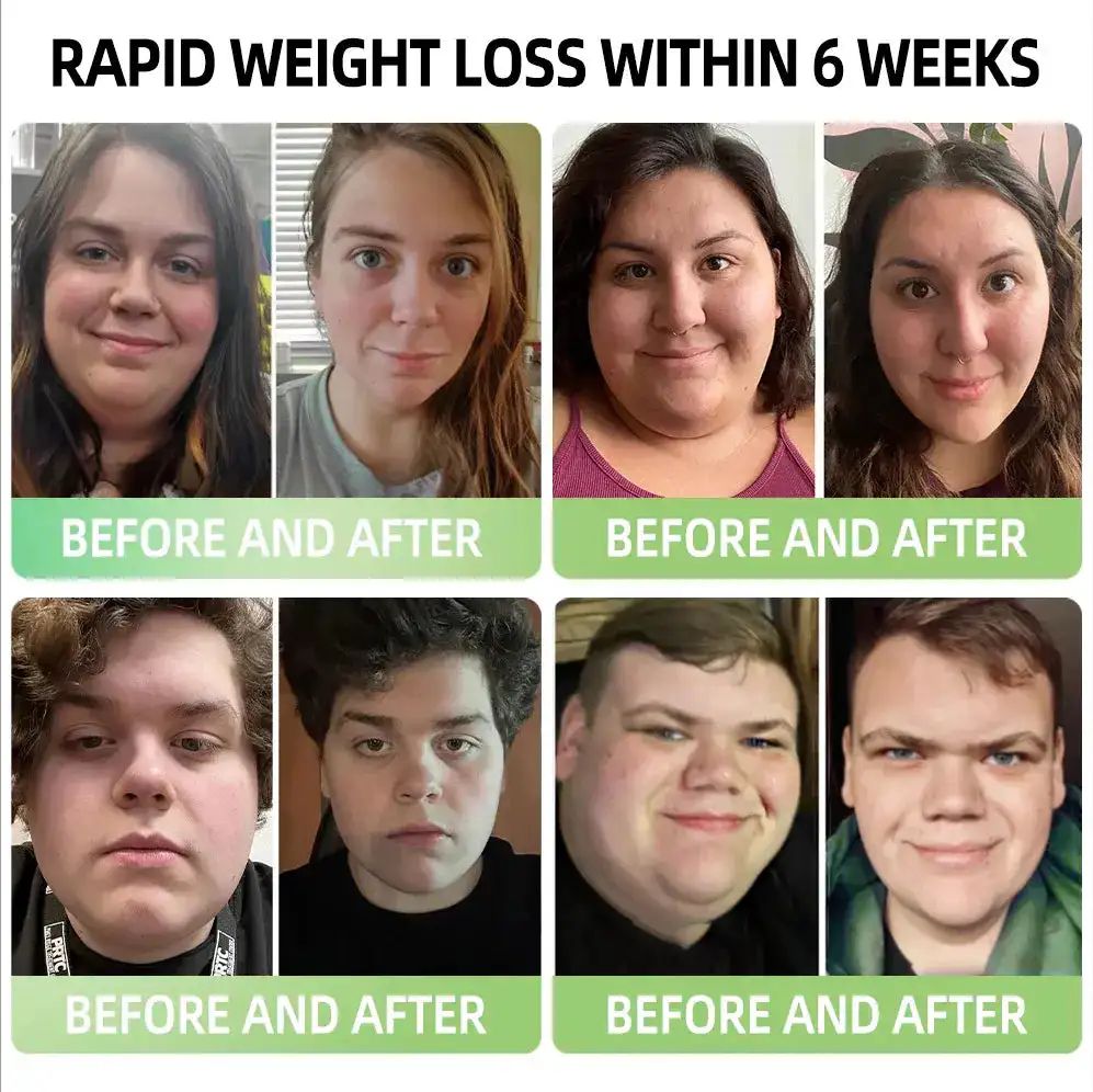 NeuroSlim Nasal Spray - Image 4