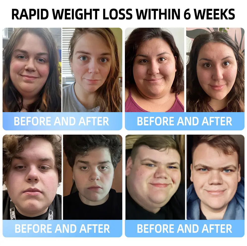 Nano Microneedle Patch - Image 5