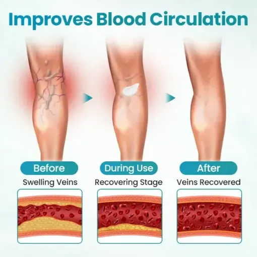 VeinAway Relief Cream - Image 3