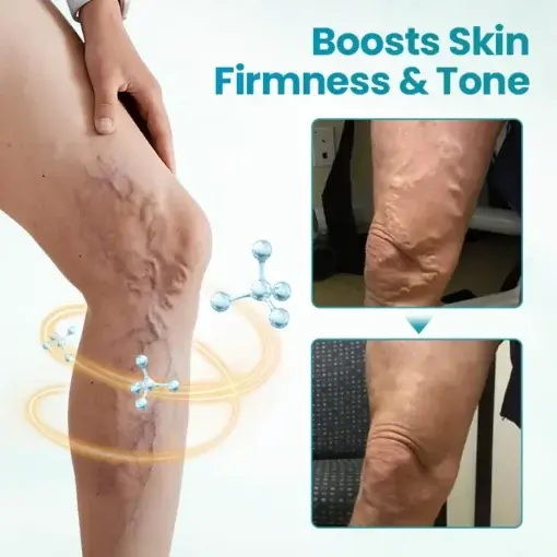 VeinAway Relief Cream - Image 5