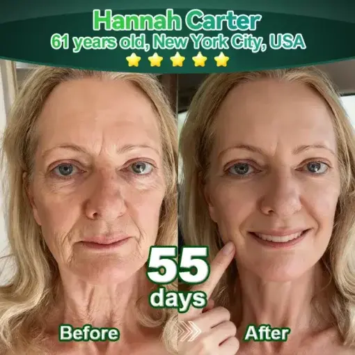 ๐๐ก๐๐ ๐ถ๐๐๐ & ๐ถ๐๐๐๐๐๐๐ ๐๐๐๐ก๐๐๐ ๐๐๐๐ ๐ท๐๐๐๐ - Image 3