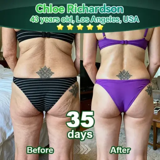 ๐๐ก๐๐ ๐ถ๐๐๐ & ๐ถ๐๐๐๐๐๐๐ ๐๐๐๐ก๐๐๐ ๐๐๐๐ ๐ท๐๐๐๐ - Image 4