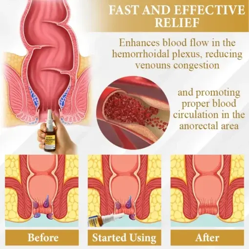 Apis Venom Hemorrhoid Cooling Spray - Image 4