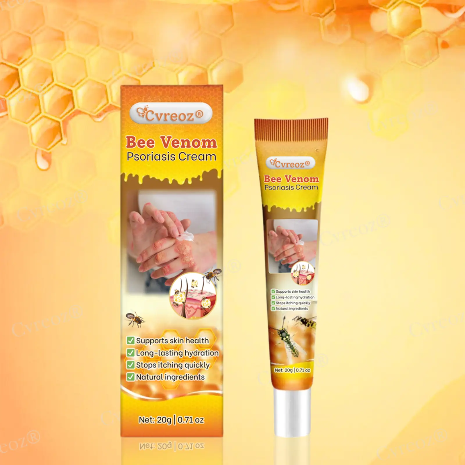 Bee Venom Psoriasis Cream