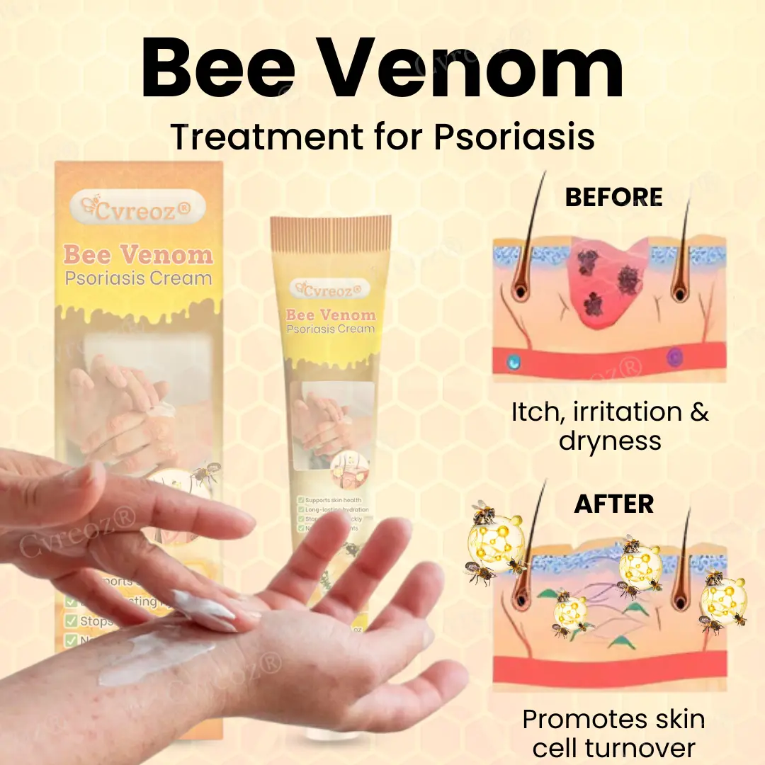 Bee Venom Psoriasis Cream - Image 6