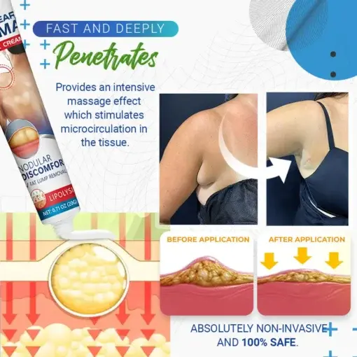 BumpClear Lipoma Removal Cream - Image 3