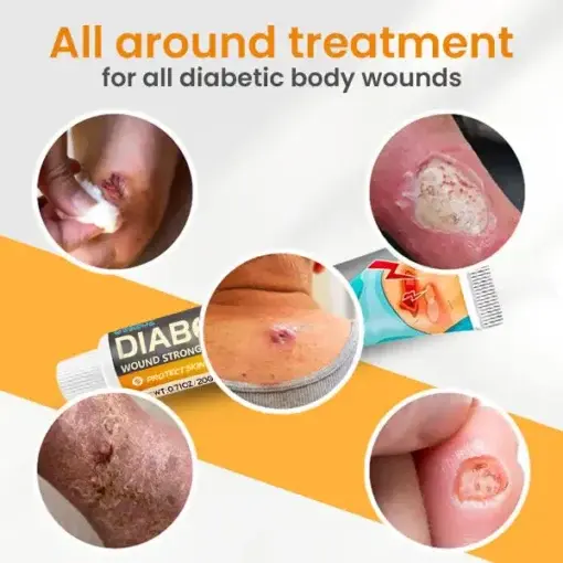 Diabetes Wound Strong Treatment Cream - Image 5