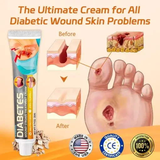 Diabetes Wound Strong Treatment Cream - Image 6