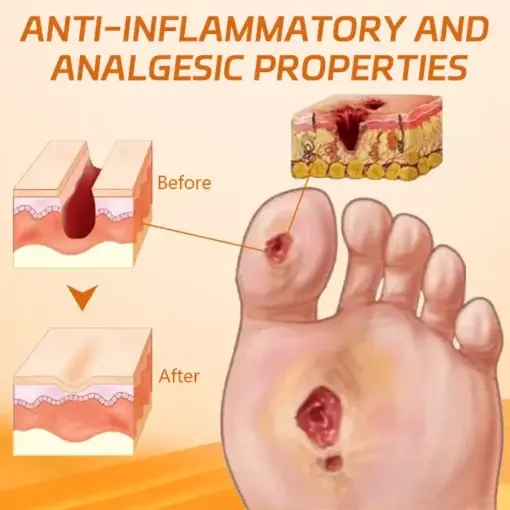 Diabetes Wound Strong Treatment Cream - Image 7