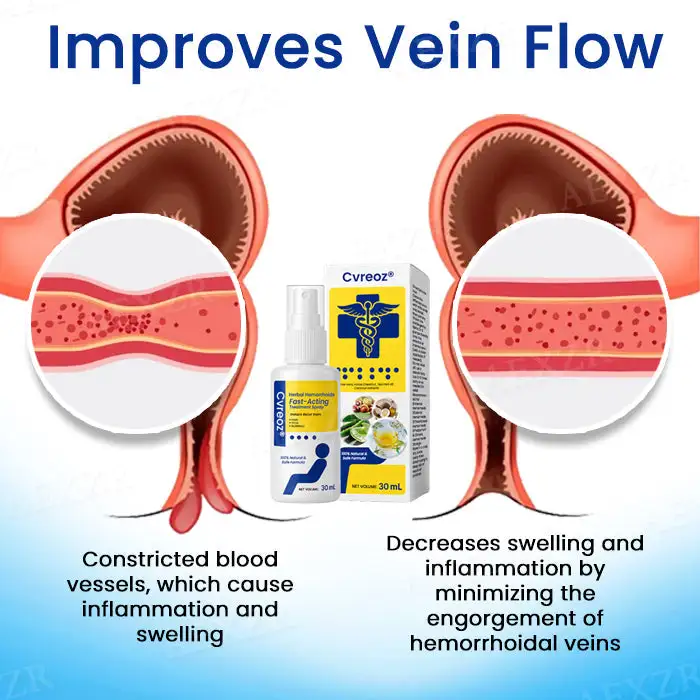 Herbal Hemorrhoids Fast-Acting Treatment Spray - Image 5