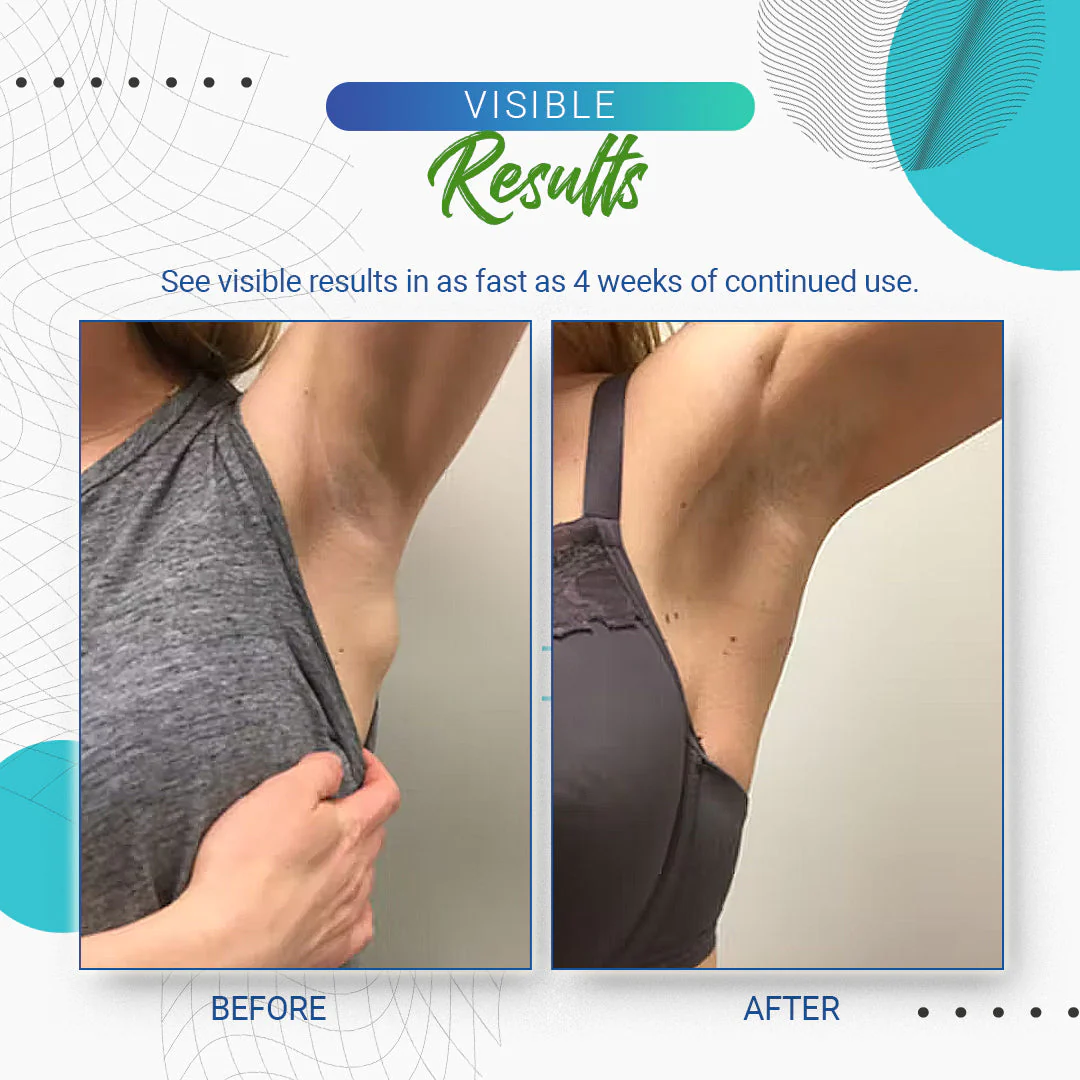 Cvreoz Lipoma Removal Cream - Image 10