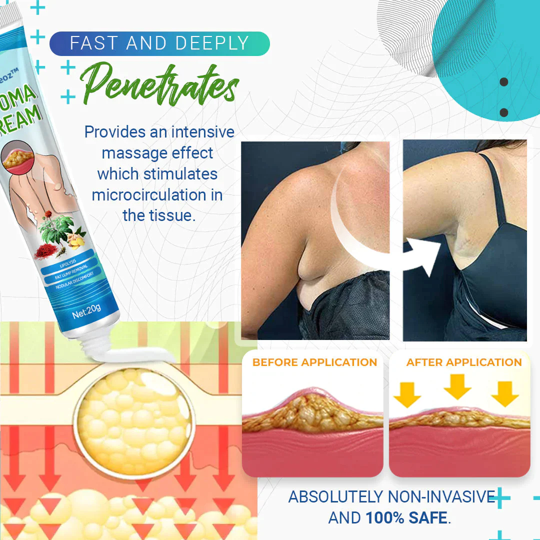 Cvreoz Lipoma Removal Cream - Image 5