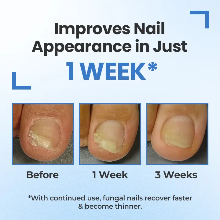 MycoErase Nail Revive Pen - Image 12