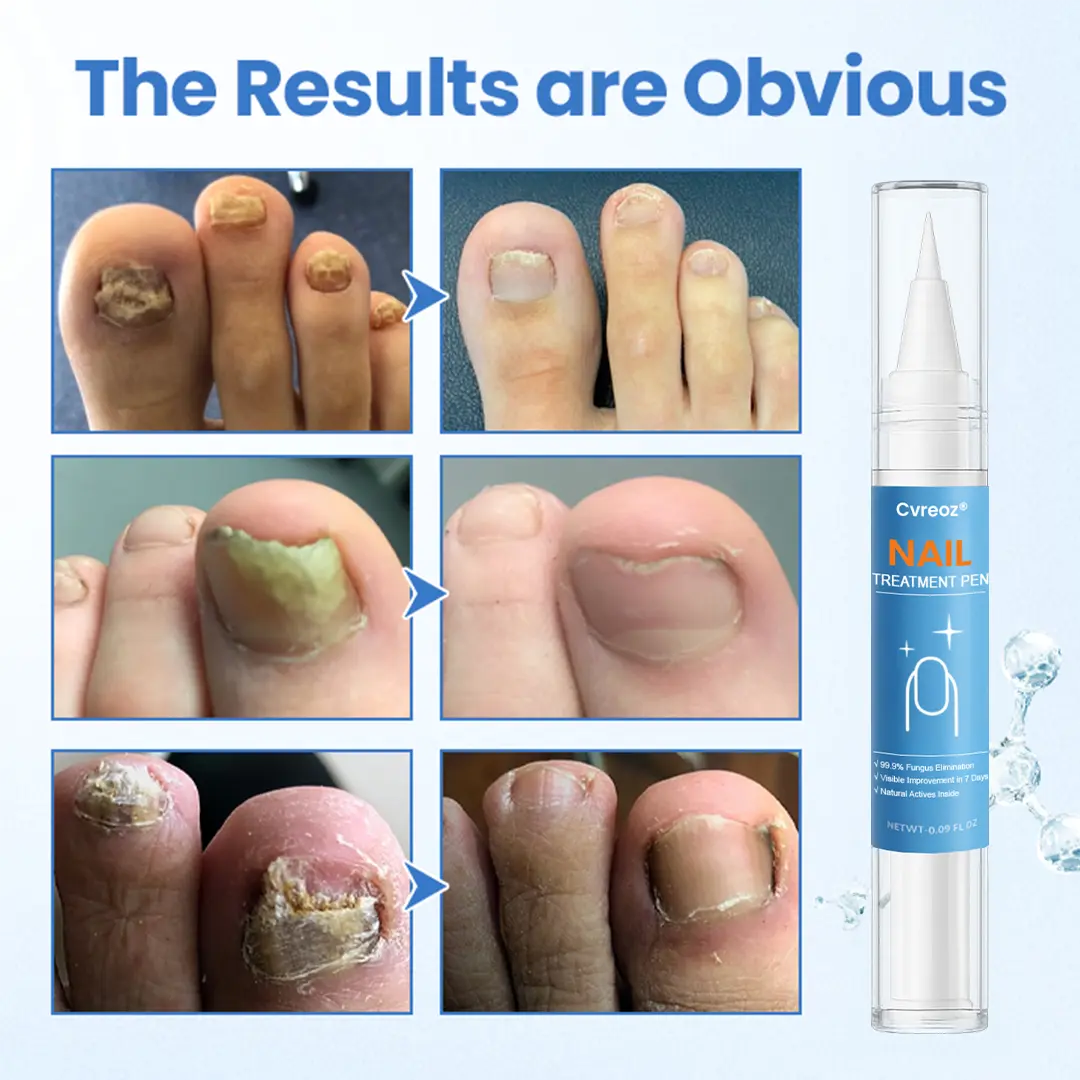 MycoErase Nail Revive Pen - Image 3