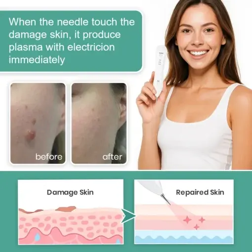 Advanced Plasma Laser Spot Cleaning Pen - Image 4