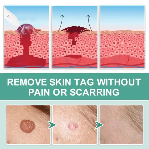 Advanced Plasma Laser Spot Cleaning Pen - Image 6