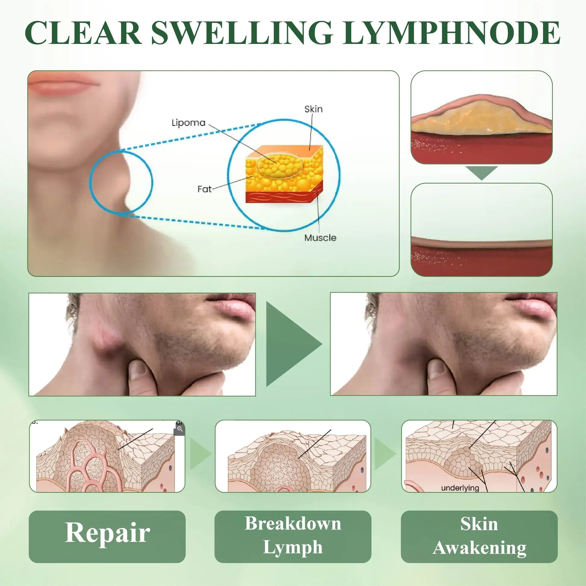 Advanced SwellCare Lymphatic Cream - Image 10