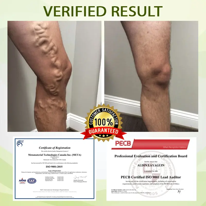 Advanced SwellCare Lymphatic Cream - Image 4