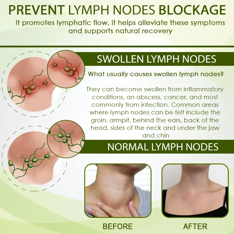 Advanced SwellCare Lymphatic Cream - Image 8
