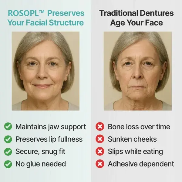 Custom Dentures for a Perfect Confident Smile! - Image 2