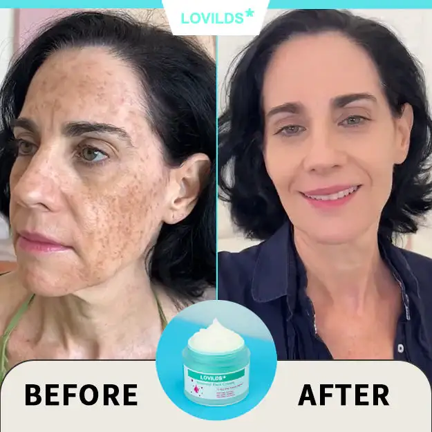 Renewal Skin Cream - Image 9