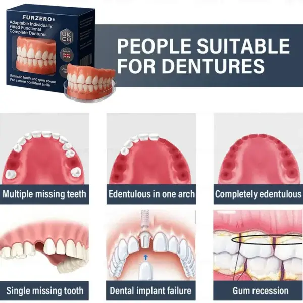 Adaptable Custom-Fit Functional Complete Dentures - Image 6