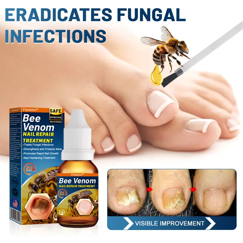 Bee Venom Nail Repair Treatment - Image 2