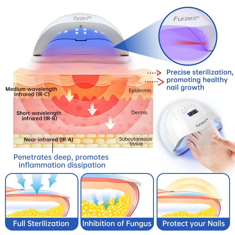 PureNail Fungus Laser Therapy Device - Image 2
