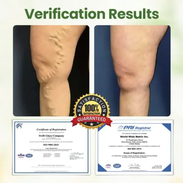 Lymphatic Detox Herbal Cream - Image 3