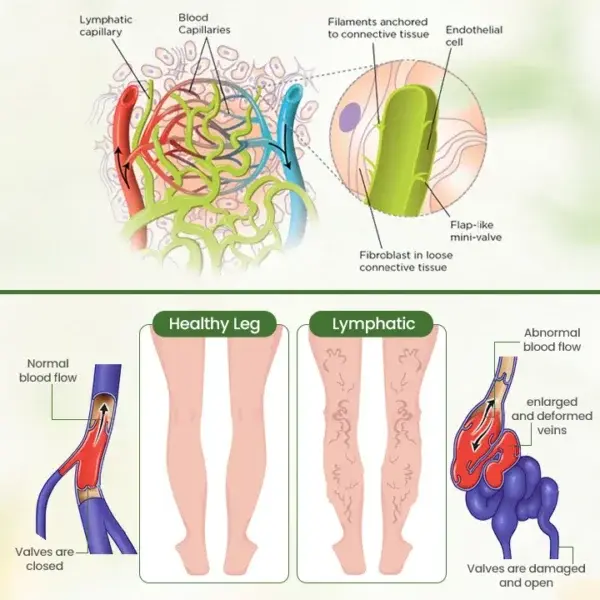 Lymphatic Detox Herbal Cream - Image 4