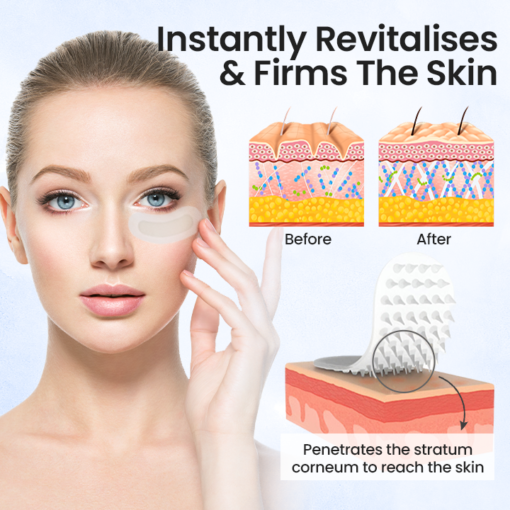 Hyaluronic Acid Microneedle Patch