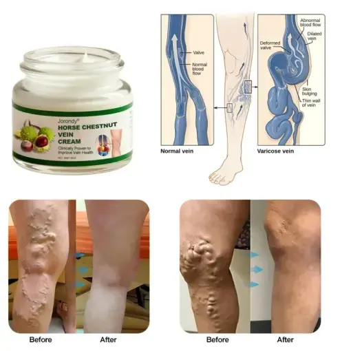Horse Chestnut Vein Cream - Image 8