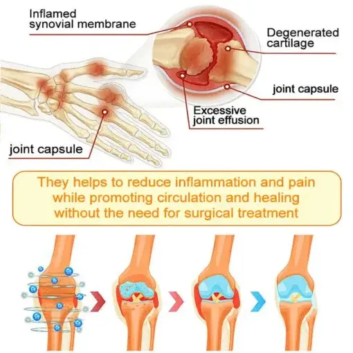 Bee Venom Pain-Relief Bone Healing Spray - Image 16