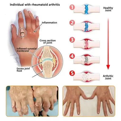 Bee Venom Pain-Relief Bone Healing roll-on-On - Image 11