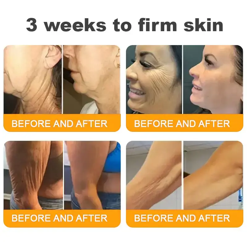 𝘽𝙀𝙀 𝙑𝙀𝙉𝙊𝙈 𝑺𝒌𝒊𝒏 𝑹𝒆𝒔𝒕𝒐𝒓𝒂𝒕𝒊𝒐𝒏 𝑪𝒓𝒆𝒂𝒎 - Image 10