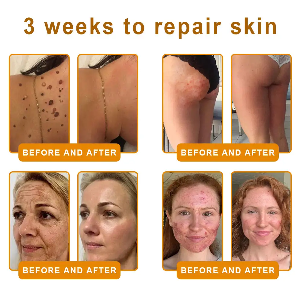 𝘽𝙀𝙀 𝙑𝙀𝙉𝙊𝙈 𝑺𝒌𝒊𝒏 𝑹𝒆𝒔𝒕𝒐𝒓𝒂𝒕𝒊𝒐𝒏 𝑪𝒓𝒆𝒂𝒎 - Image 9