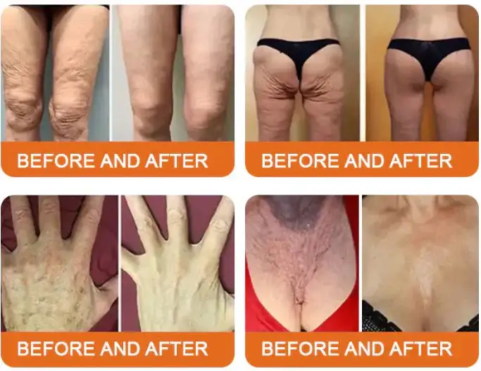 Bee Toxin Lift Cream - Image 4