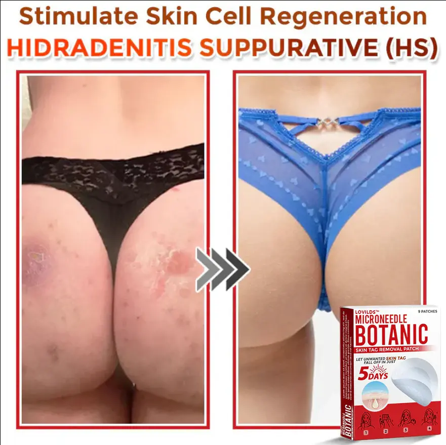 Removal Patch - Image 11