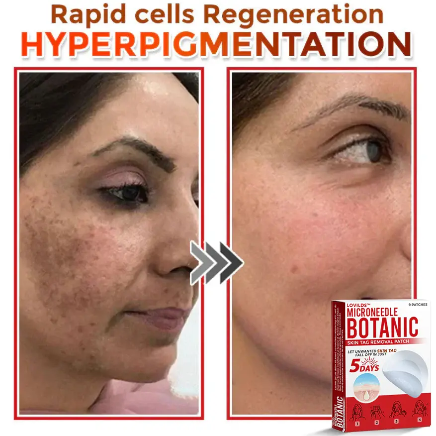 Removal Patch - Image 9