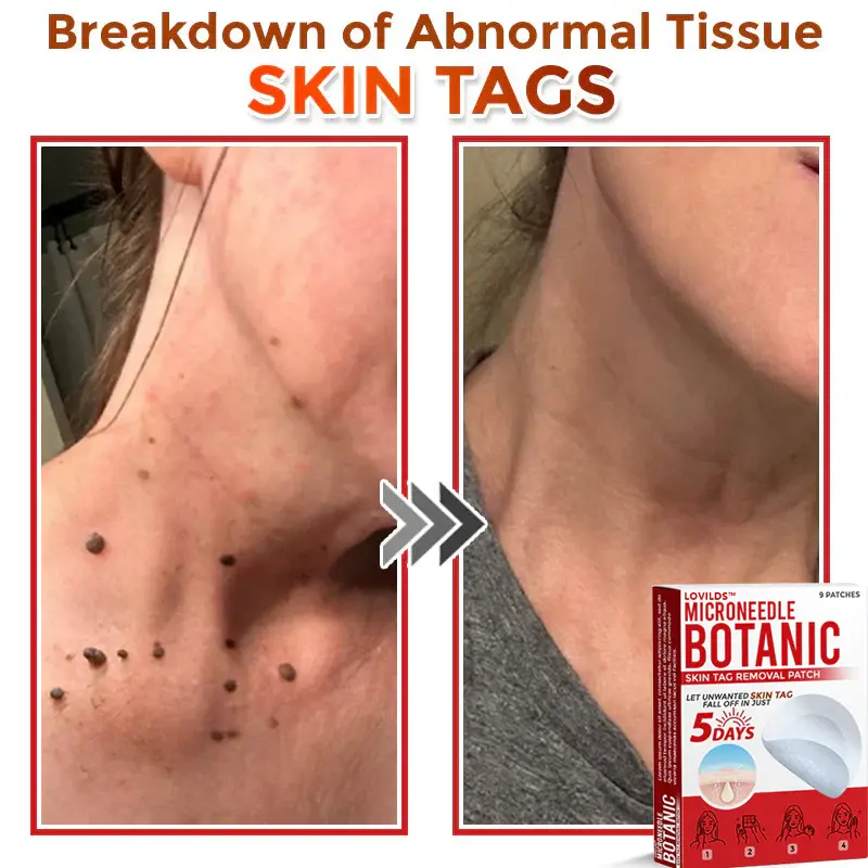 Removal Patch - Image 6