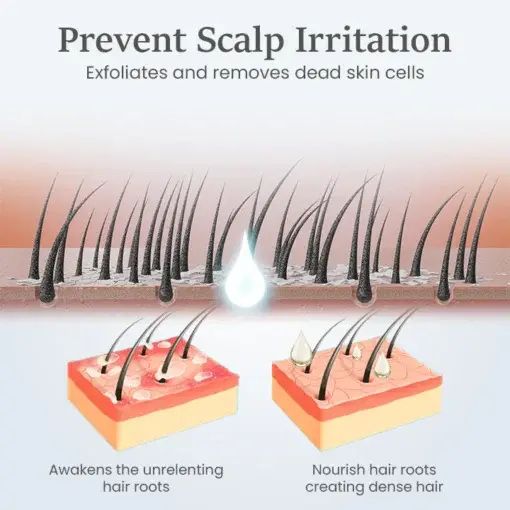 ThickTress Hair Growth Spray - Image 5